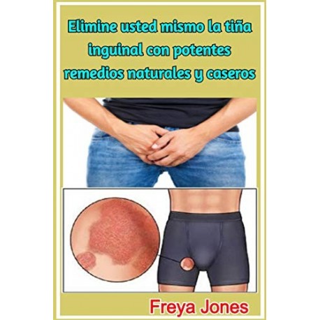 Elimine usted mismo la tiña inguinal con potentes remedios naturales y caseros   Freya Jones